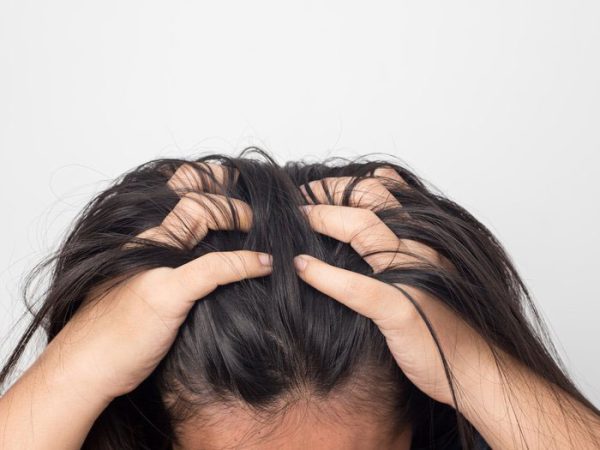 شوره سر چیست