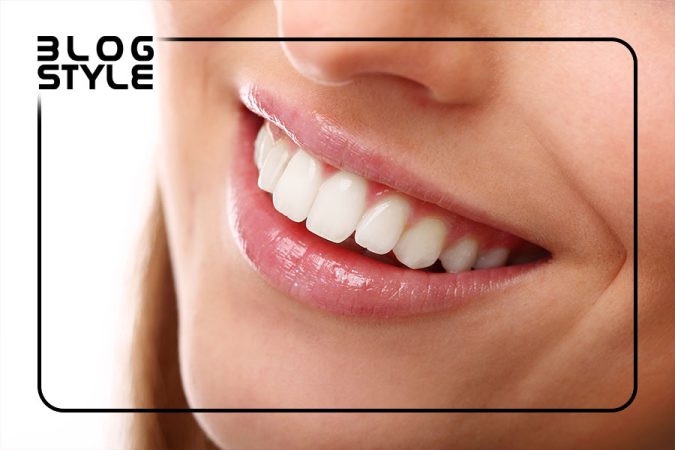 روش سفيد كردن دندانها
