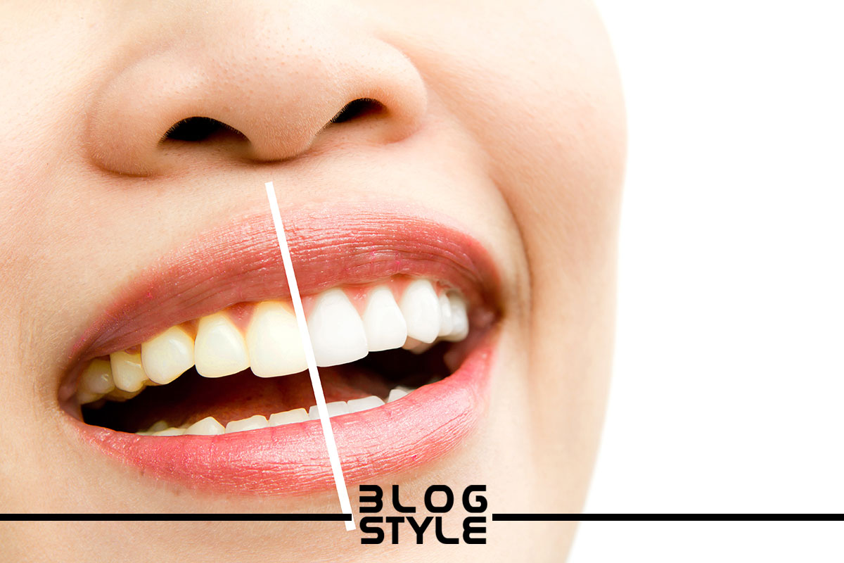 چگونه دندان های خود را سفید کنیم روش خانگی