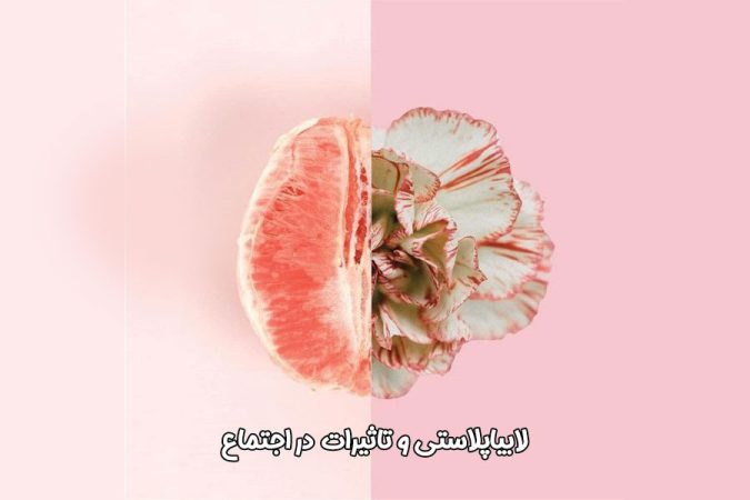 تغییرات روانی و اجتماعی پس از لابیاپلاستی