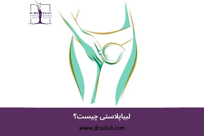 لبیاپلاستی؛ مدرن‌ترین روش زیباسازی واژن
