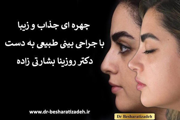 چهره ای جذاب و زیبا با جراحی بینی طبیعی