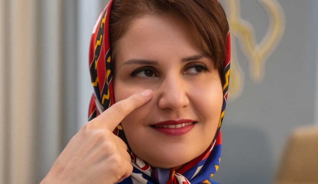 جوانسازی دور چشم در مشهد